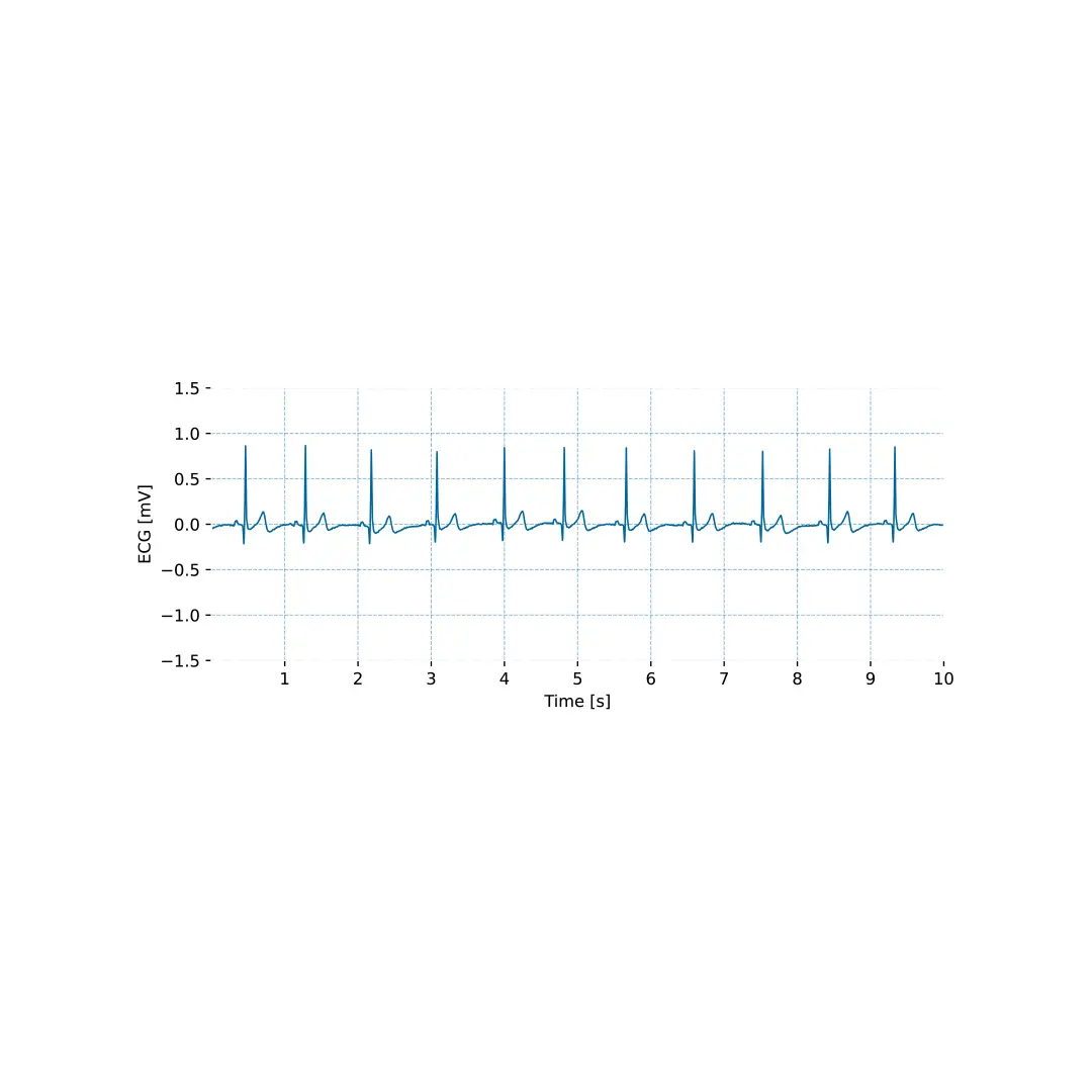 Electrocardiography (ECG) Sensor - Image 8