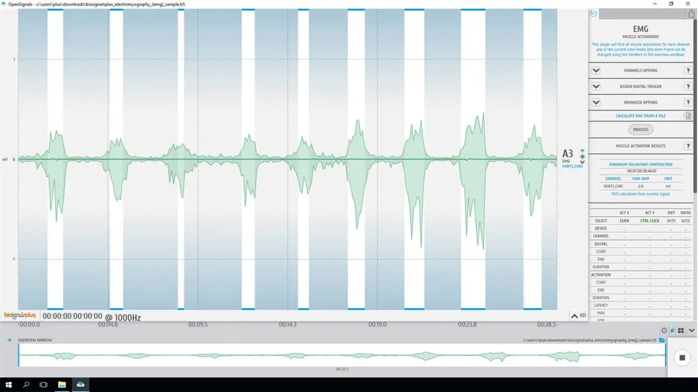 Electromyography (EMG) Analysis Add-on - Image 3